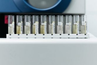 how-proper-labeling-improves-accuracy-and-safety-in-the-modern-lab