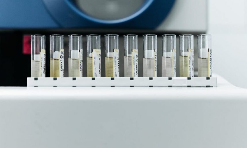 how-proper-labeling-improves-accuracy-and-safety-in-the-modern-lab